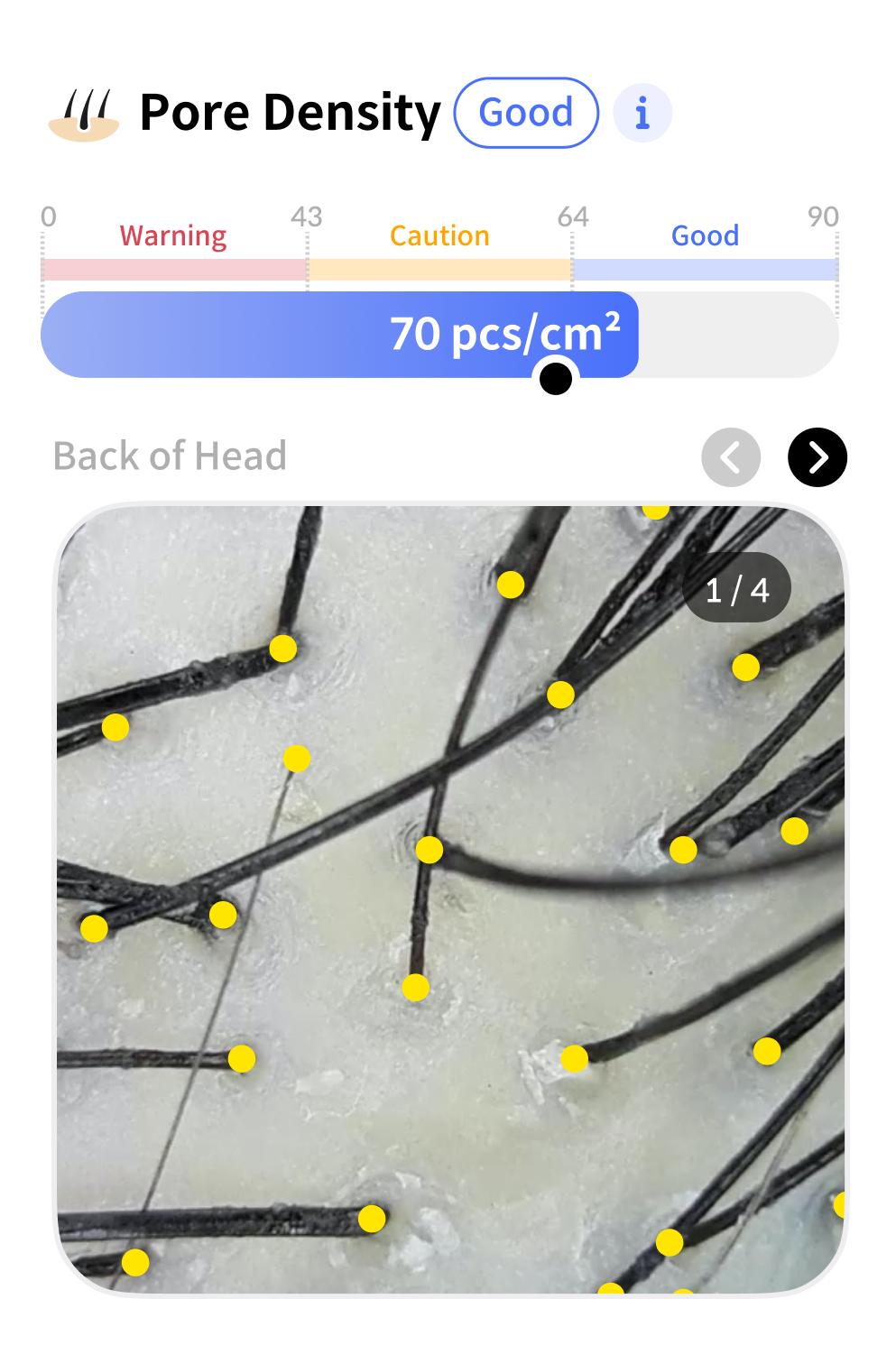 Scanner analysis data 5