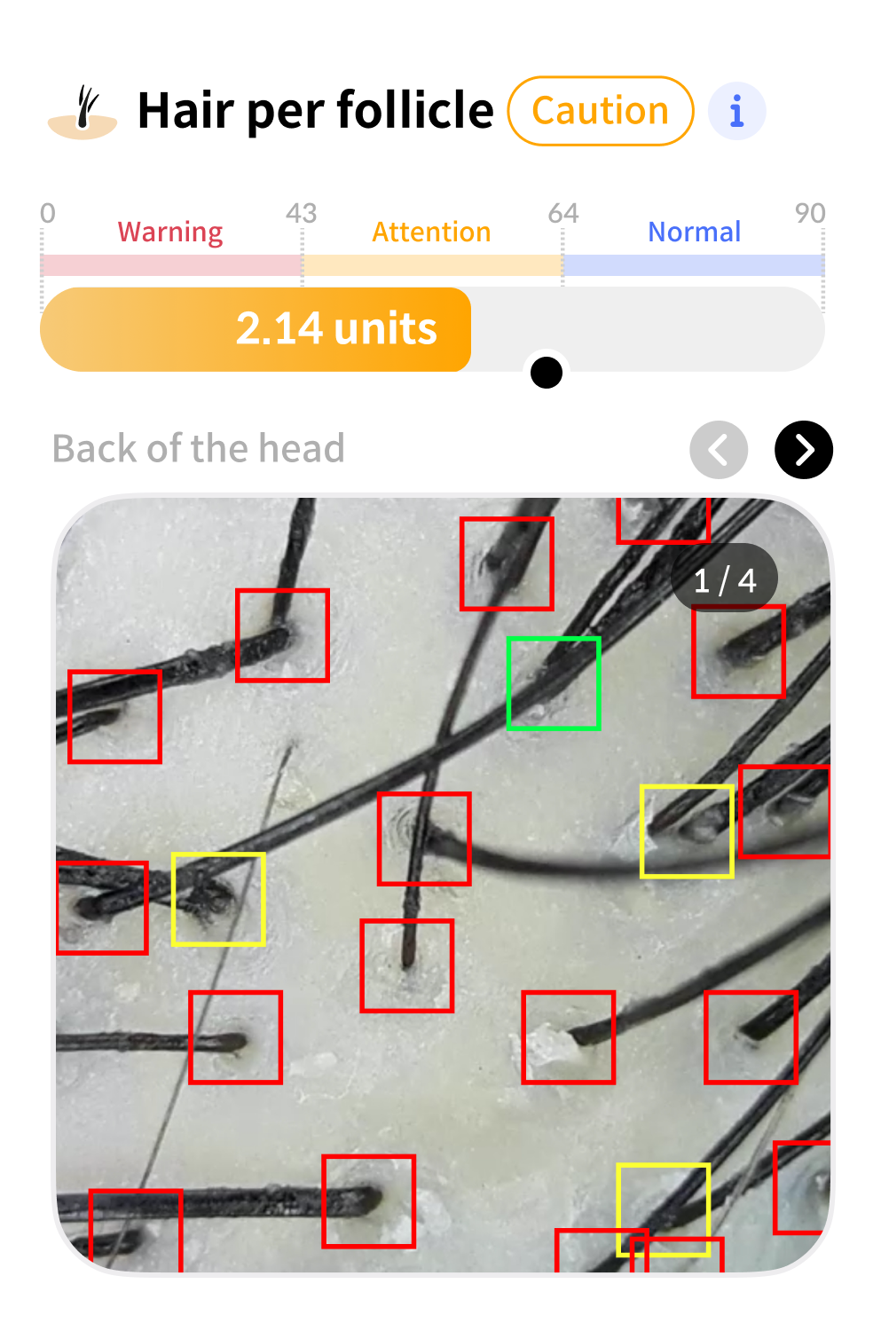 Scanner analysis data 7