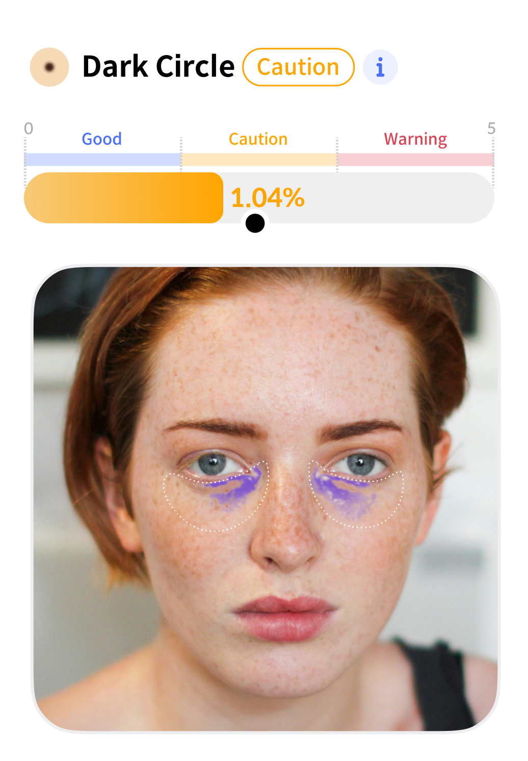 Dark Circle Analysis