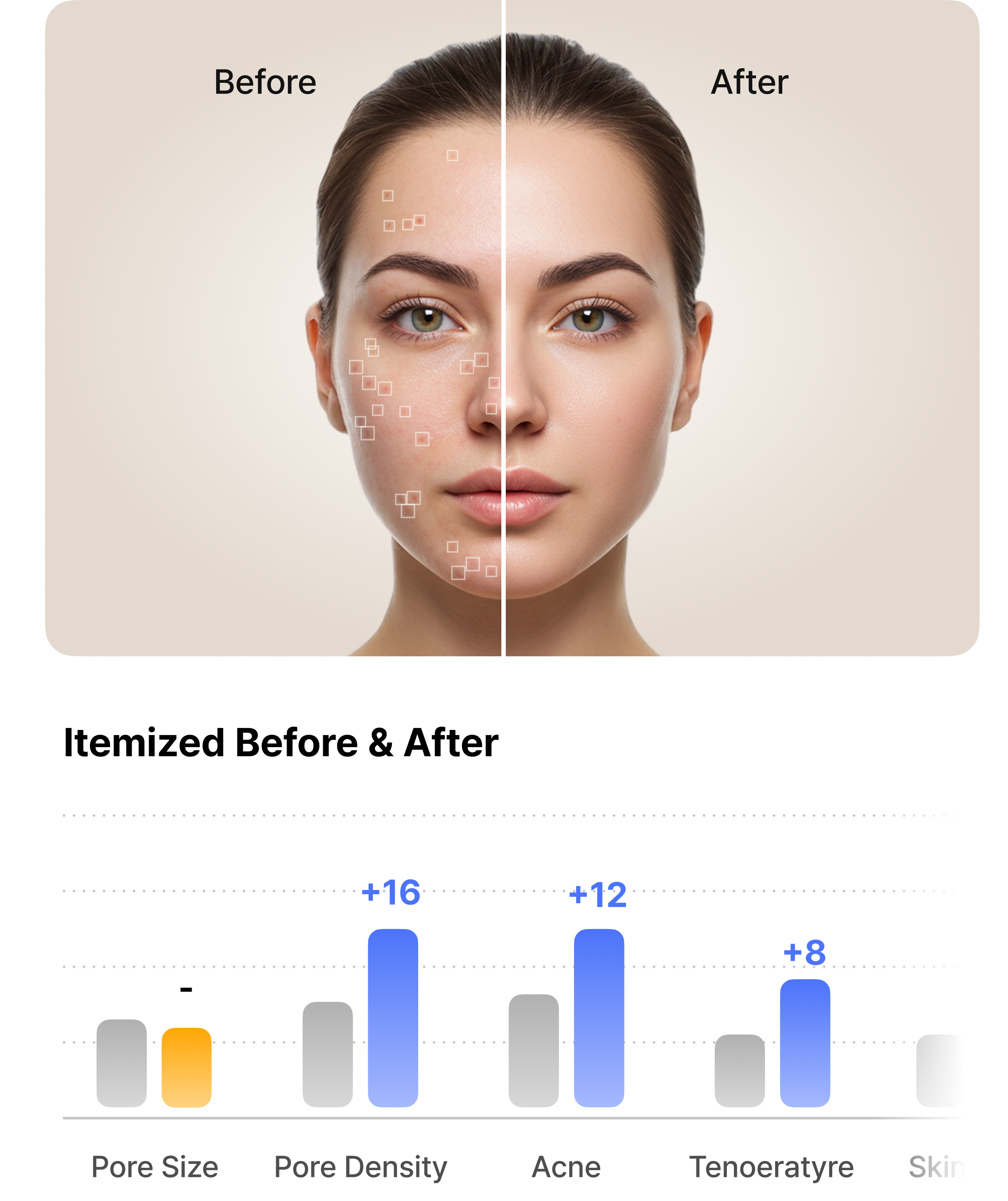 Precise Skin Before & After Analysis