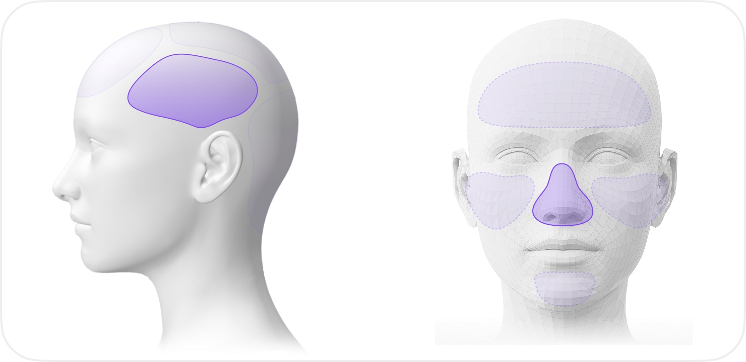 By Area (Crown, Frontal, etc.)