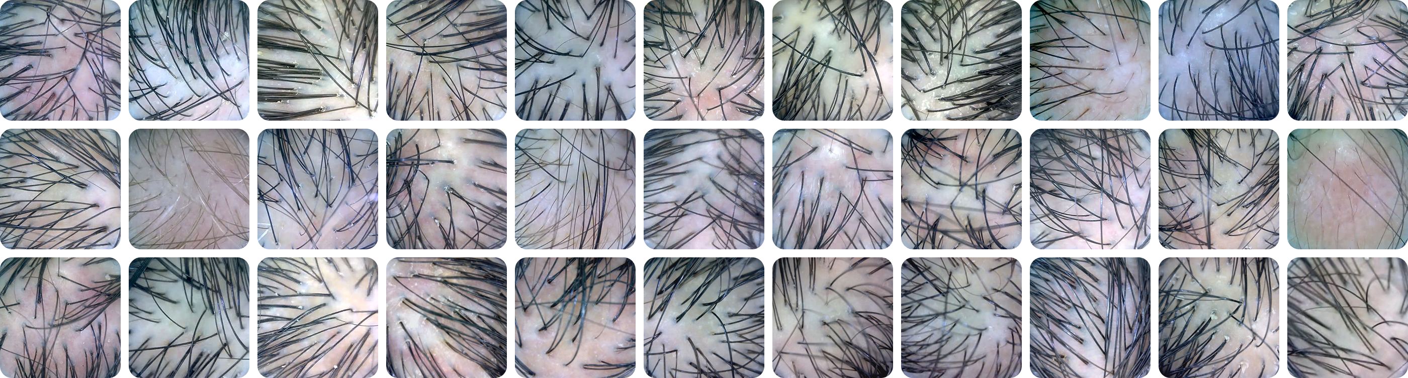 Scalp database samples