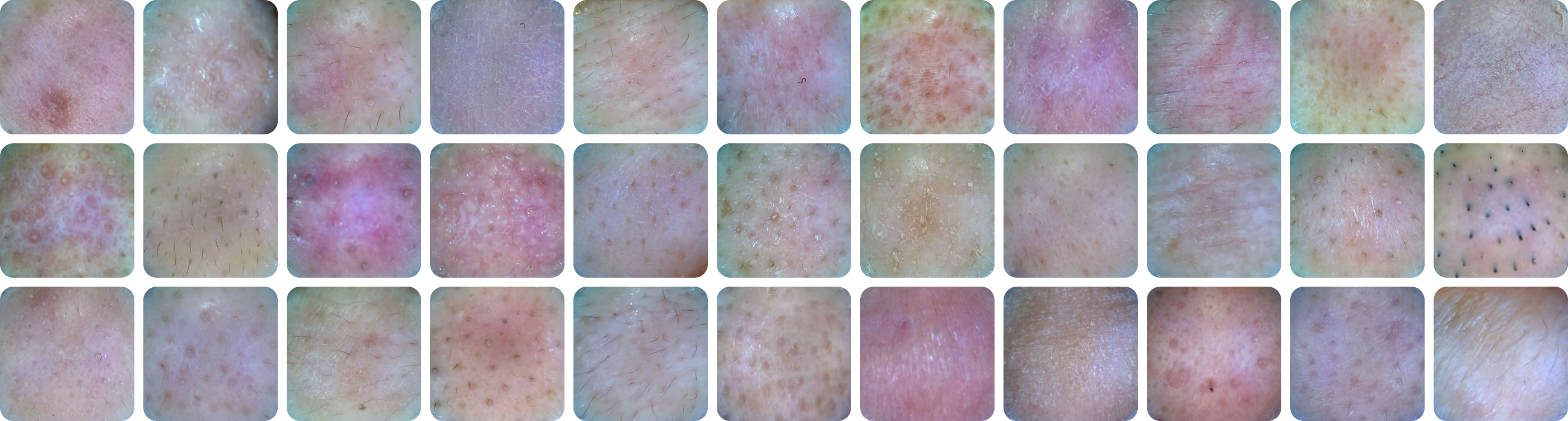 Skin database samples