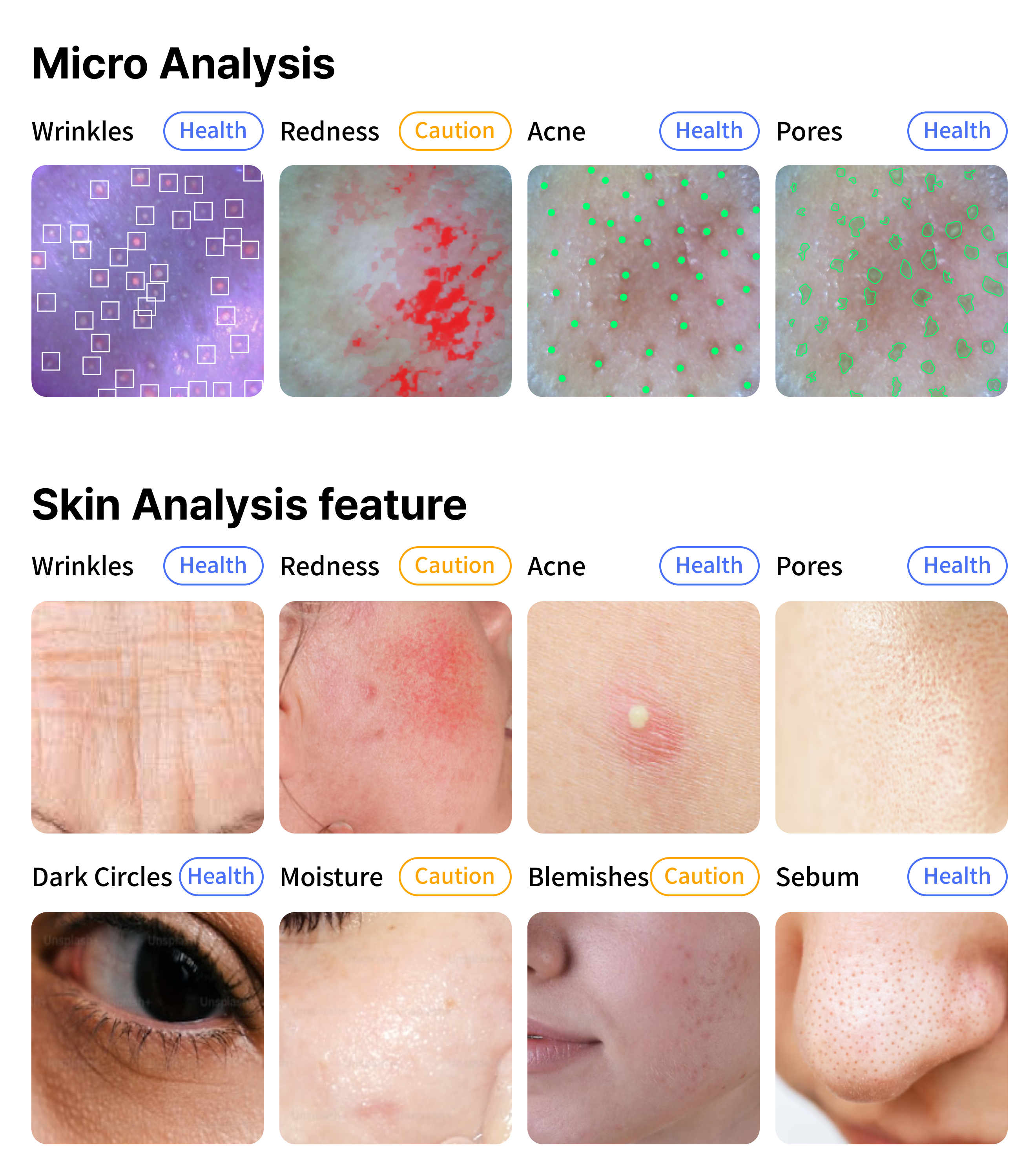 Skin Micro & Macro Analysis