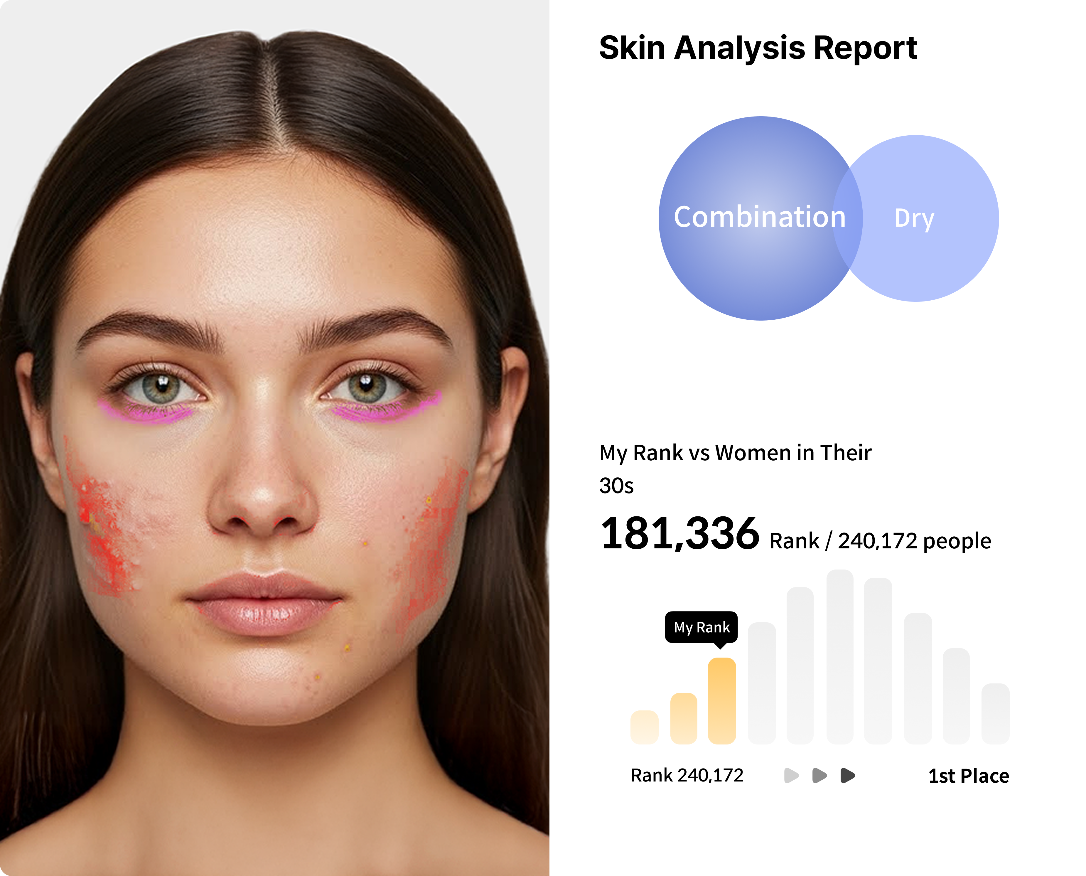 Skin Analysis Report